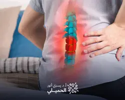 علاج الفتق الغضروفي بدون جراحة