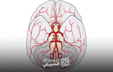 قسطرة المخ العلاجية