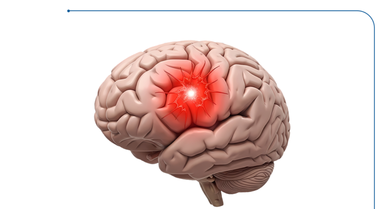 علاج التجمع الدموي في المخ - أحدث الطرق مع الدكتور يسري الحميلي