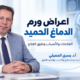 اعراض ورم الدماغ الحميد: العلامات والأسباب والأنواع وطرق العلاج