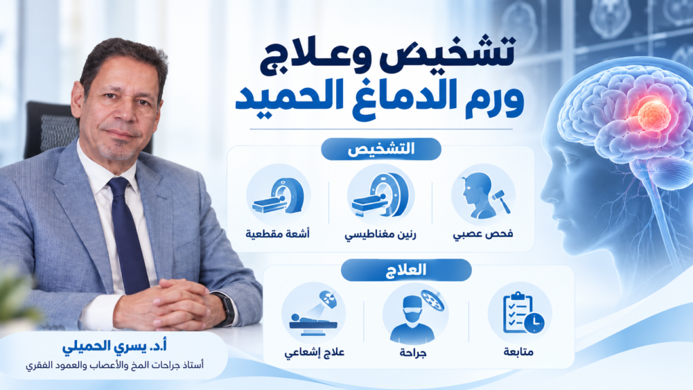اعراض ورم الدماغ الحميد: العلامات والأسباب والأنواع وطرق العلاج