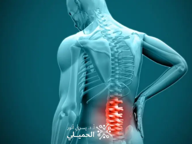 اعراض انزلاق الفقرات القطنية