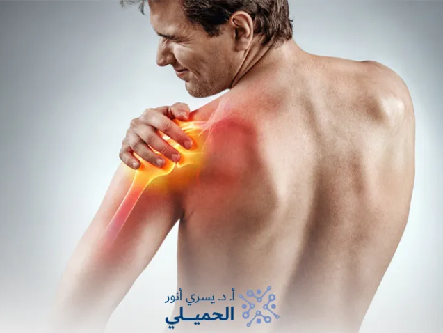 أعراض-ضعف-الأعصاب-والعضلات