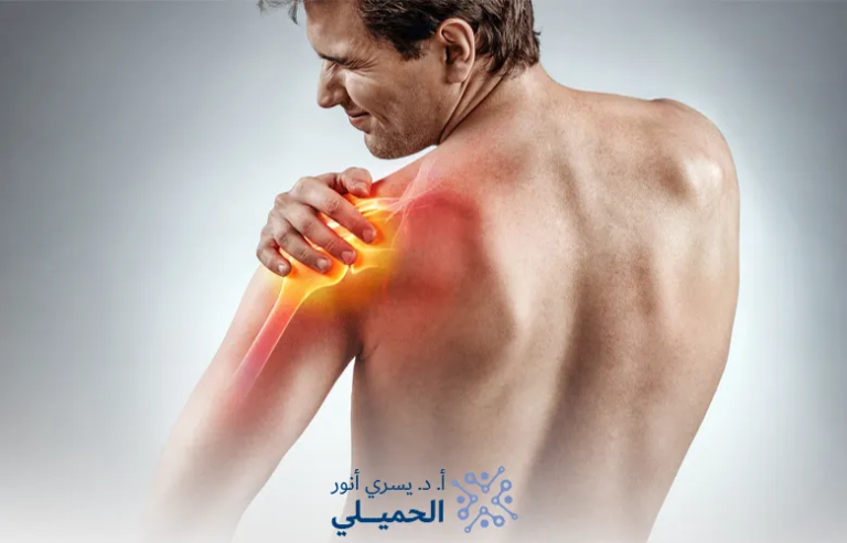 أعراض-ضعف-الأعصاب-والعضلات