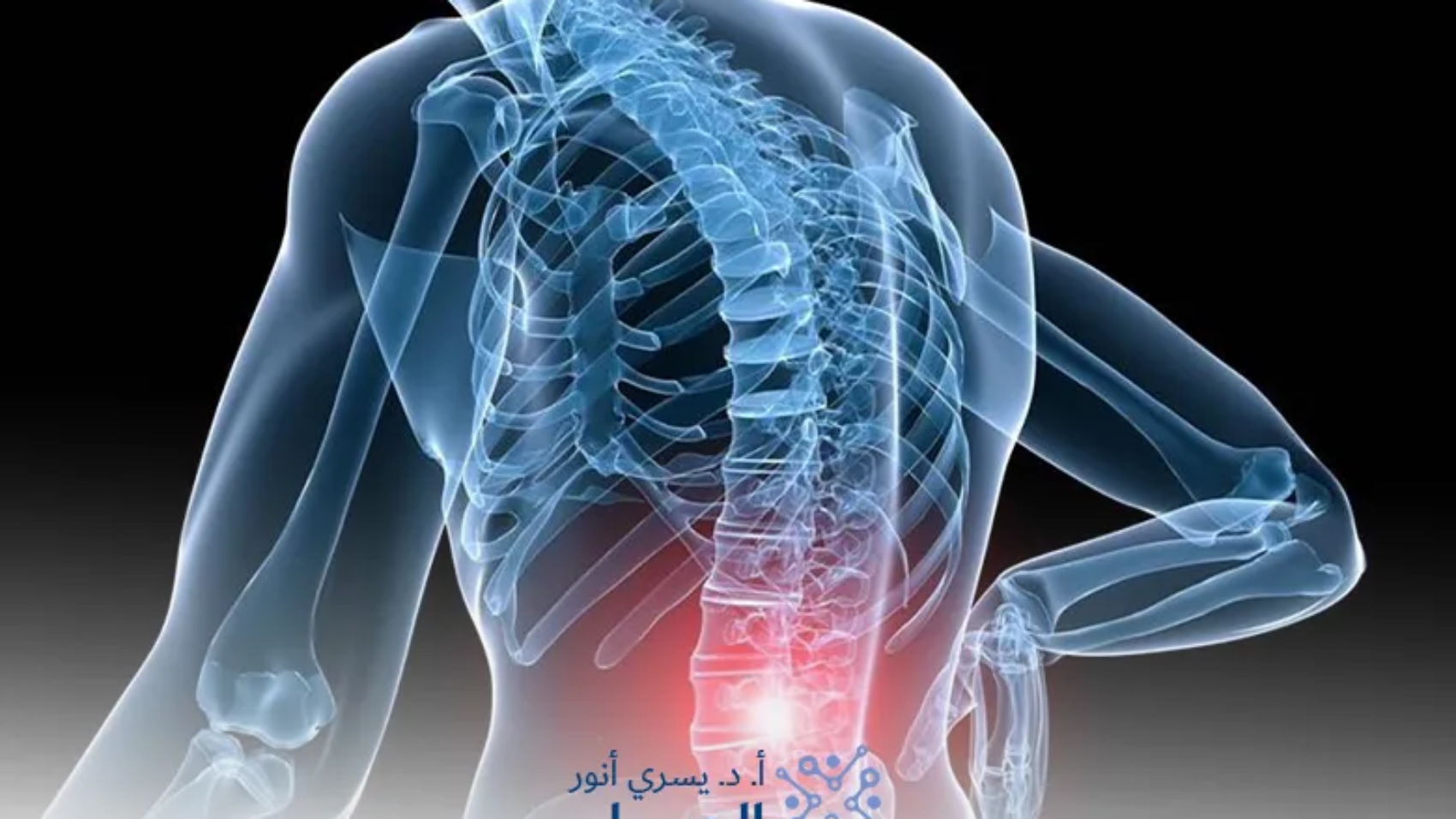 إعوجاج-العمود-الفقري