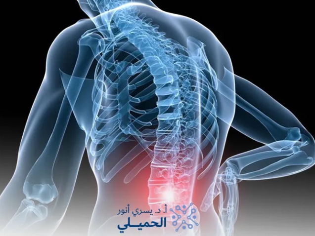إعوجاج-العمود-الفقري