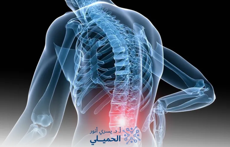 إعوجاج-العمود-الفقري