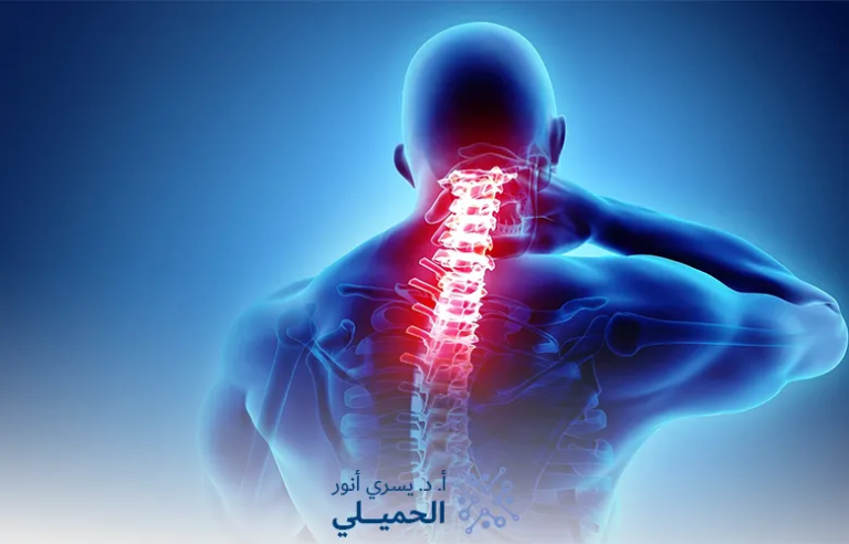 اعراض-الانزلاق-الغضروفي-العنقي