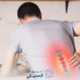 افضل-دكتور-لعلاج-الانزلاق-الغضروفي-في-مصر