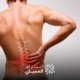 افضل-علاج-للغضروف-الظهر