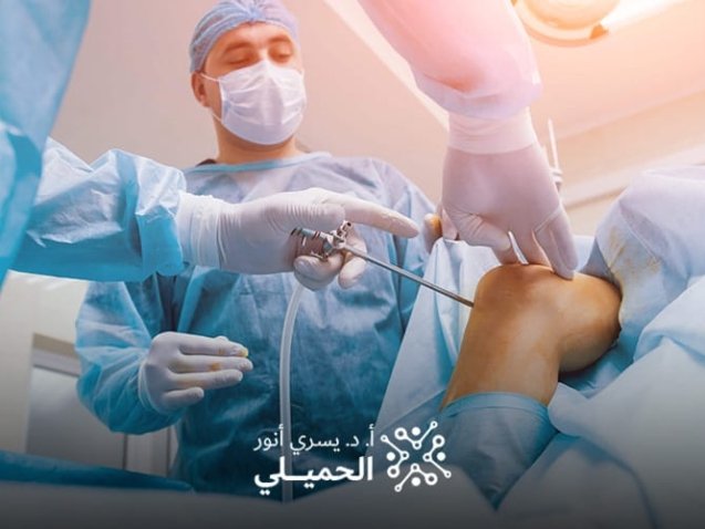 تكلفة عملية الغضروف بالمنظار في مصر