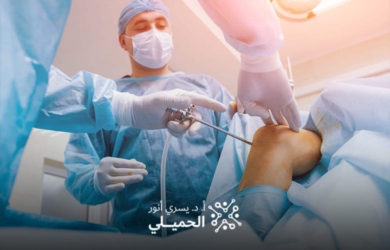 تكلفة-عملية-الغضروف-بالمنظار-في-مصر