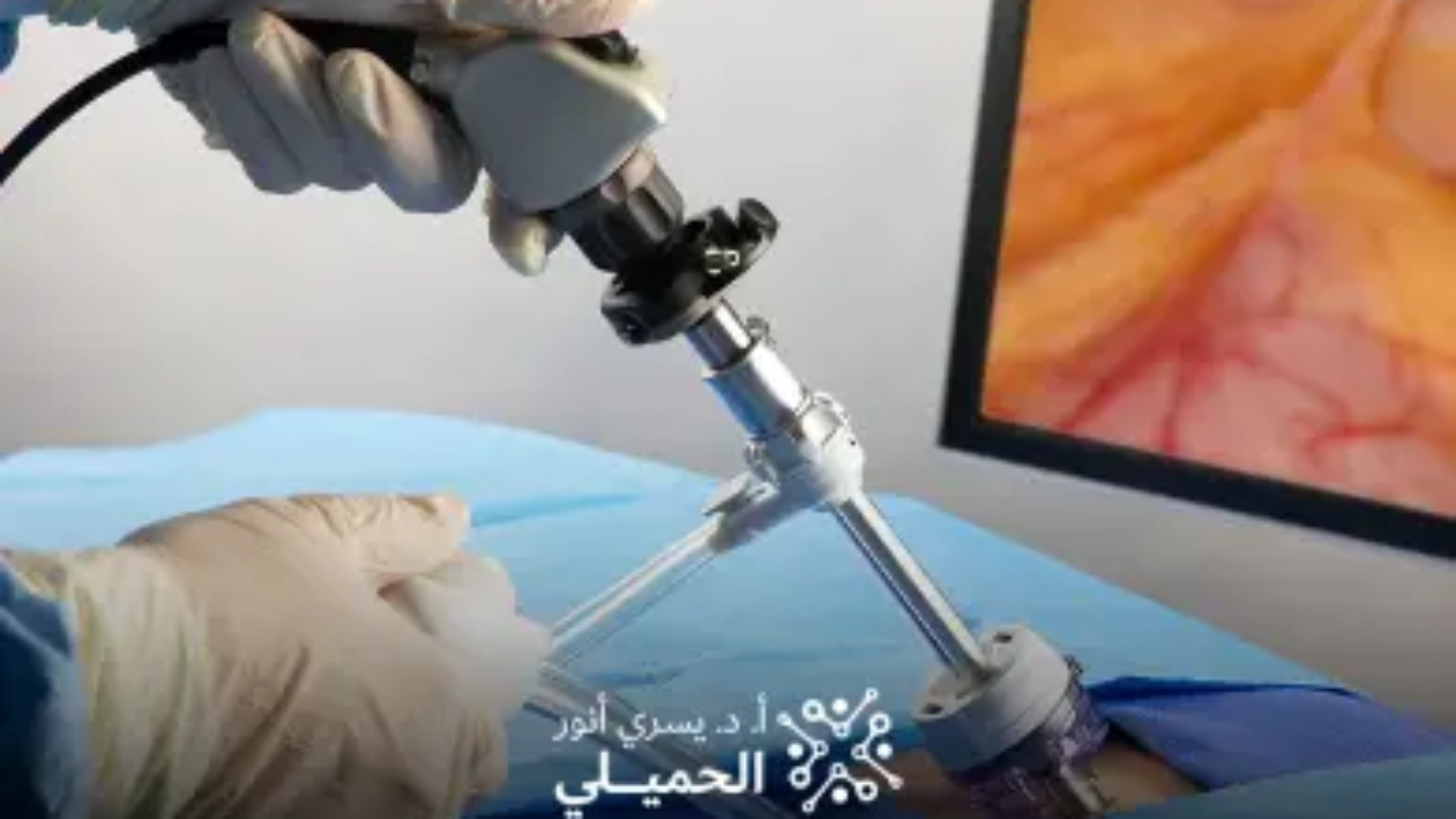 تكلفة-عملية-توسيع-القناة-العصبية-بالمنظار (1)