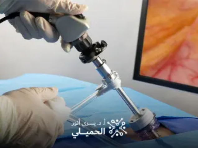 تكلفة-عملية-توسيع-القناة-العصبية-بالمنظار (1)