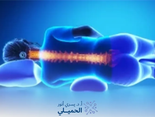 طريقة-النوم-الصحيحة-لمرضى-الانزلاق-الغضروفي
