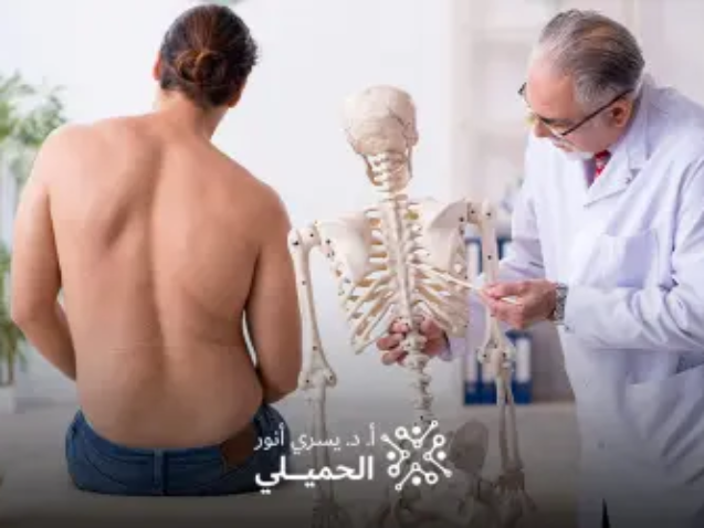 علاج-اعوجاج-العمود-الفقري-بدون-جراحة