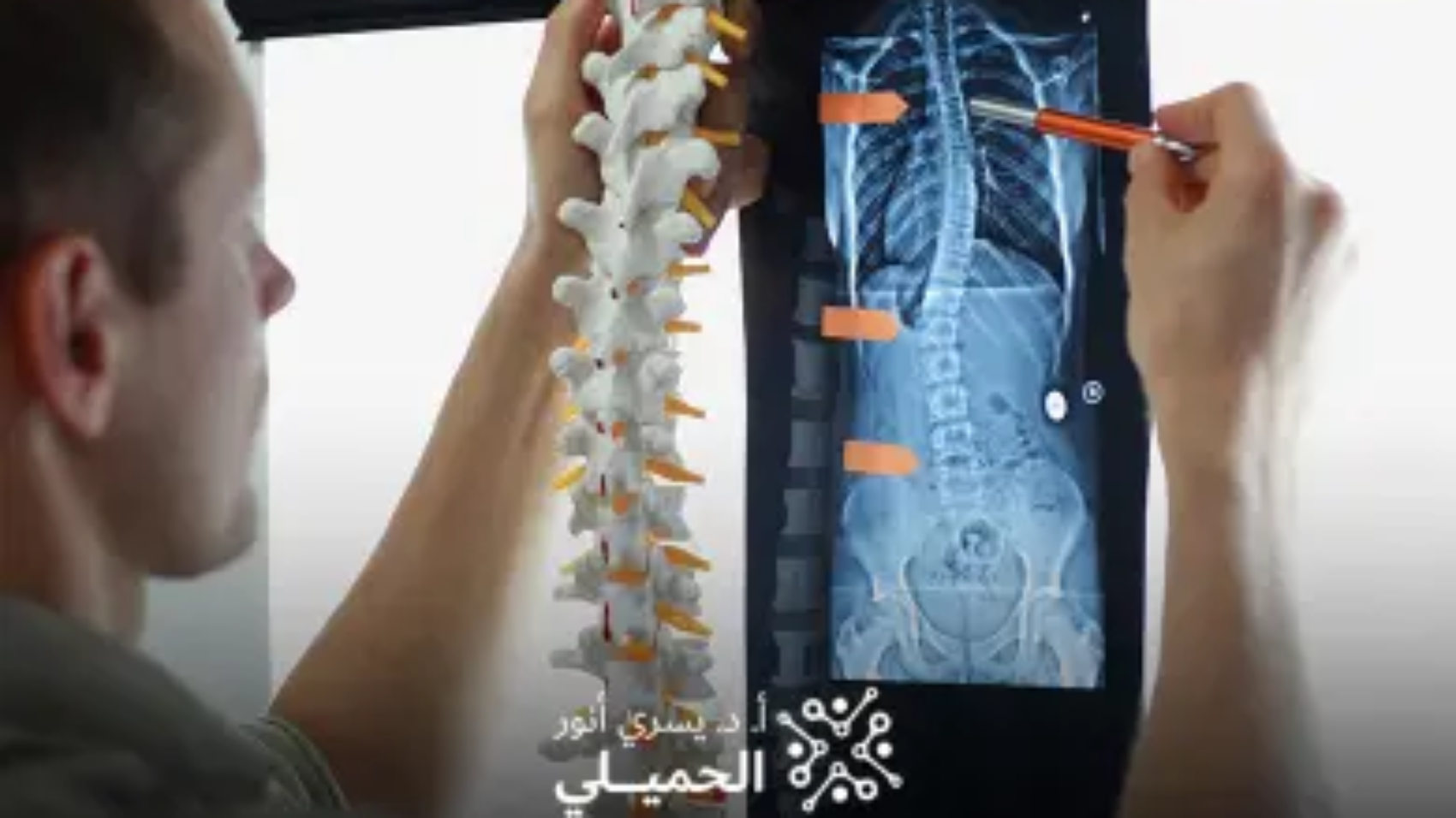 علاج-الالتصاقات-بعد-عملية-الغضروف