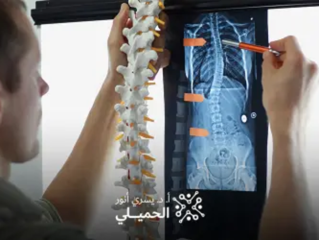 علاج-الالتصاقات-بعد-عملية-الغضروف