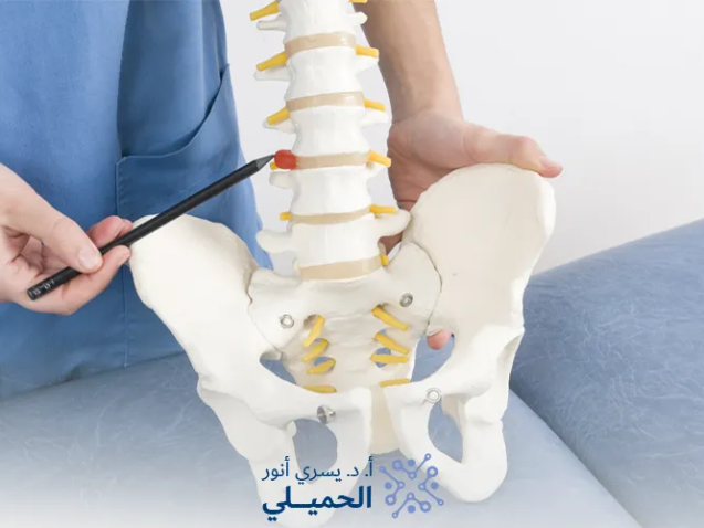 علاج-الفتق-الغضروفي-بدون-جراحة