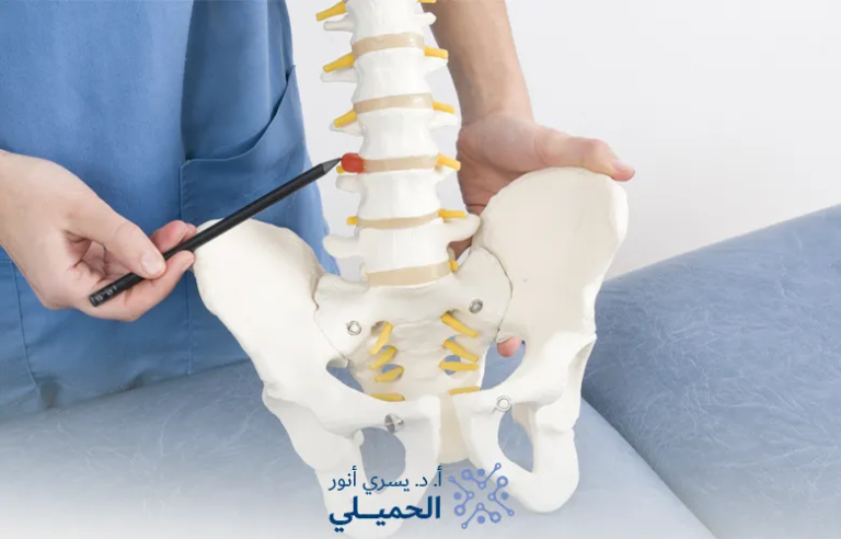 علاج-الفتق-الغضروفي-بدون-جراحة