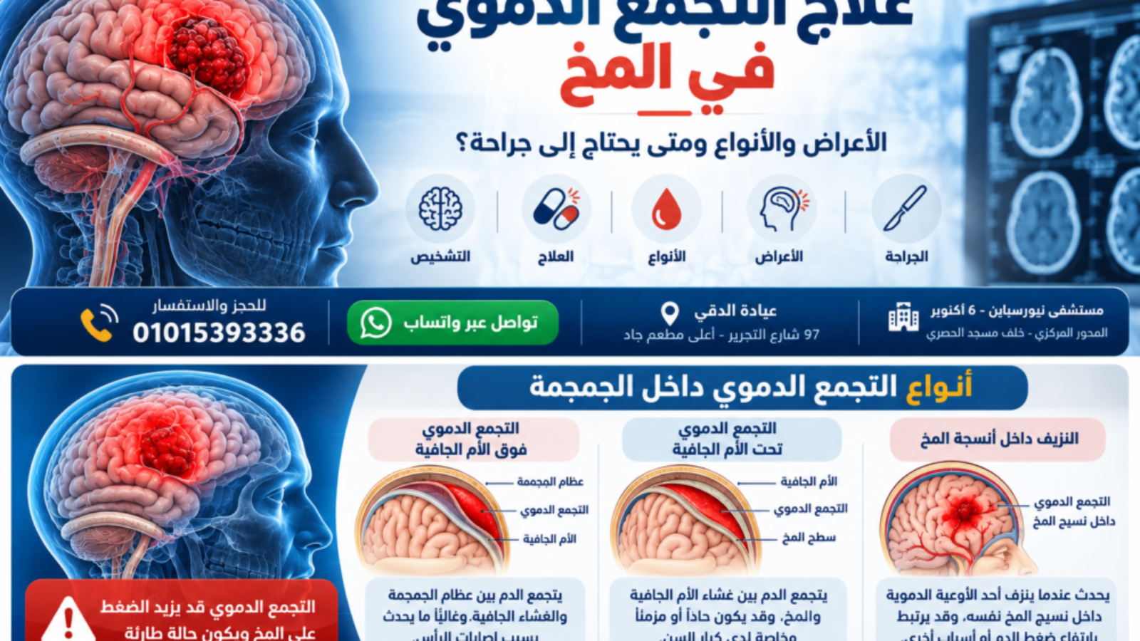 علاج وأنواع التجمع الدموي بالمخ