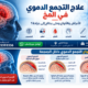 علاج وأنواع التجمع الدموي بالمخ