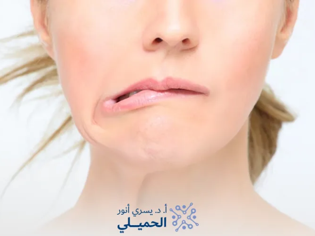 علامات-تحسن-العصب-السابع