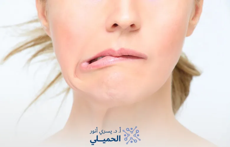 علامات-تحسن-العصب-السابع