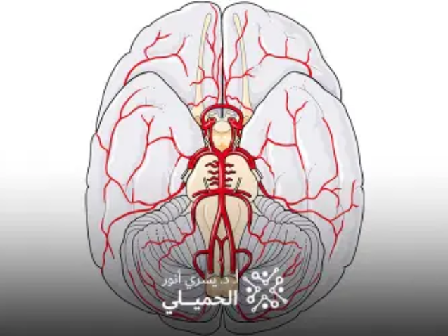 قسطرة-المخ-العلاجية