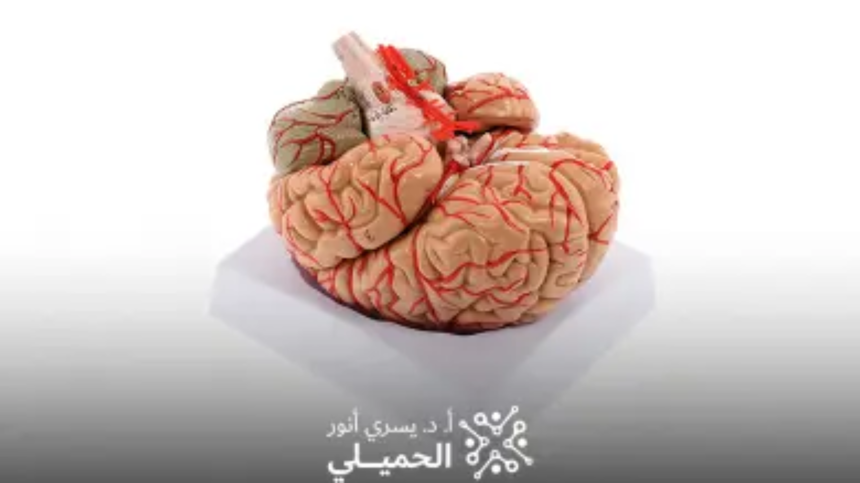 قسطرة-تشخيصية-على-شرايين-المخ