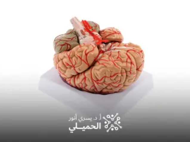 قسطرة-تشخيصية-على-شرايين-المخ