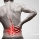 اسباب الام اسفل الظهر وعلاجها