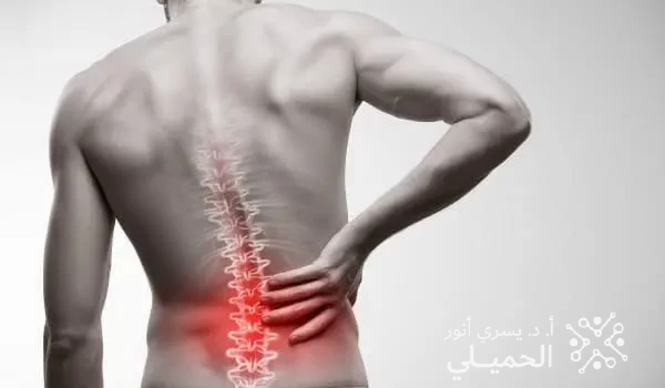 اسباب الام اسفل الظهر وعلاجها