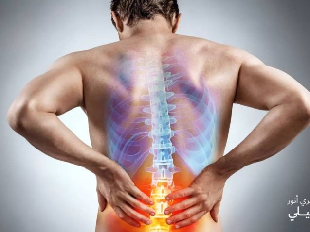 عرق النسا أسبابه وأعراضه وطرق العلاج الحديثة