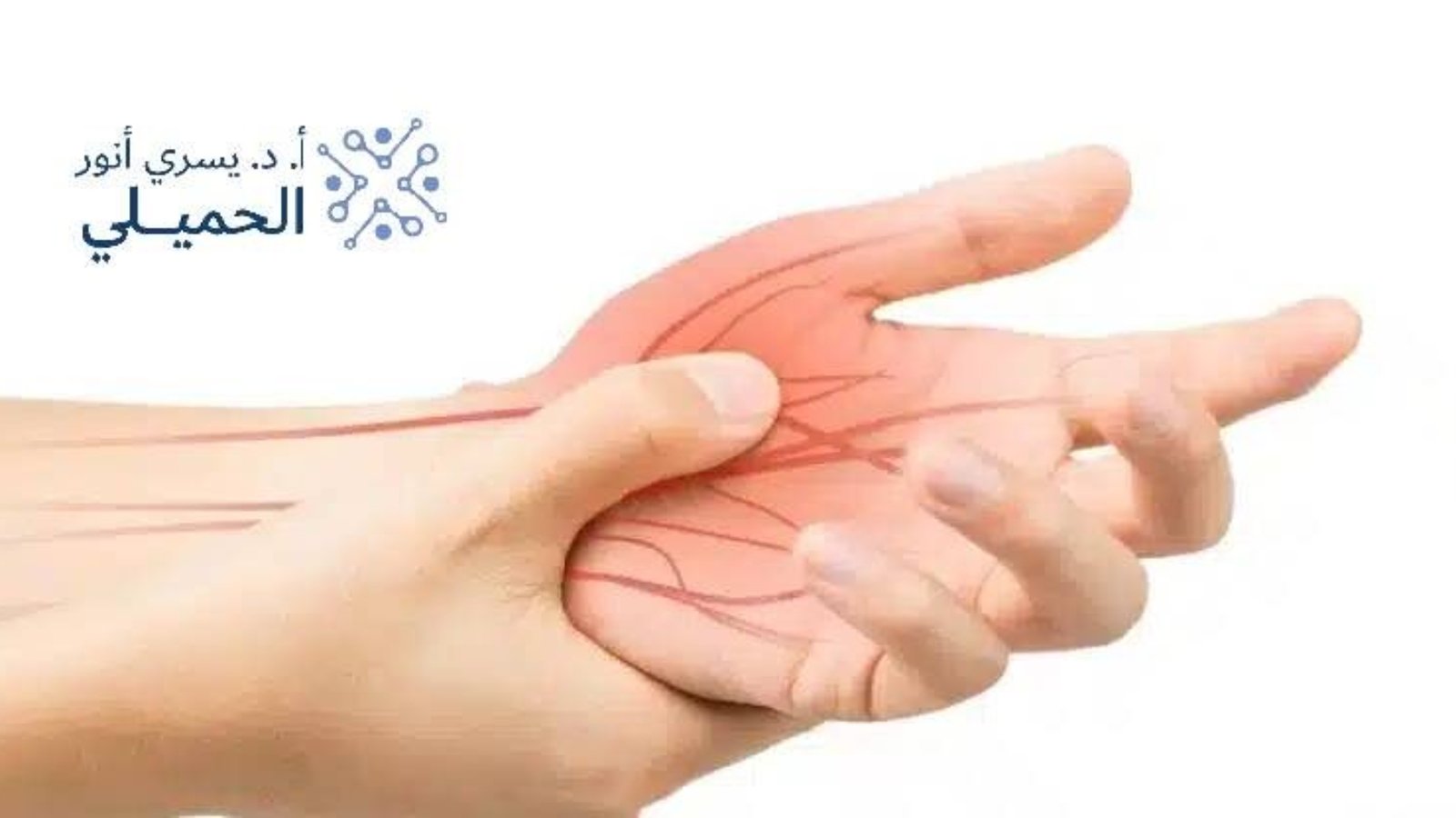 علاج-اختناق-عصب-اليد-بدون-جراحة