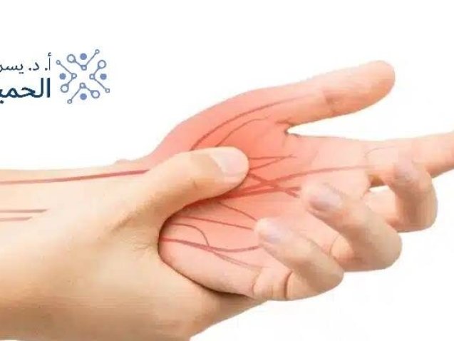 علاج-اختناق-عصب-اليد-بدون-جراحة