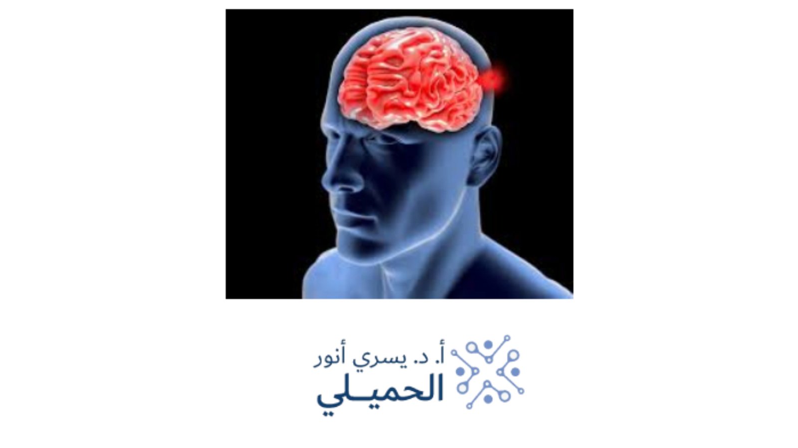 الورم الليفي العصبي