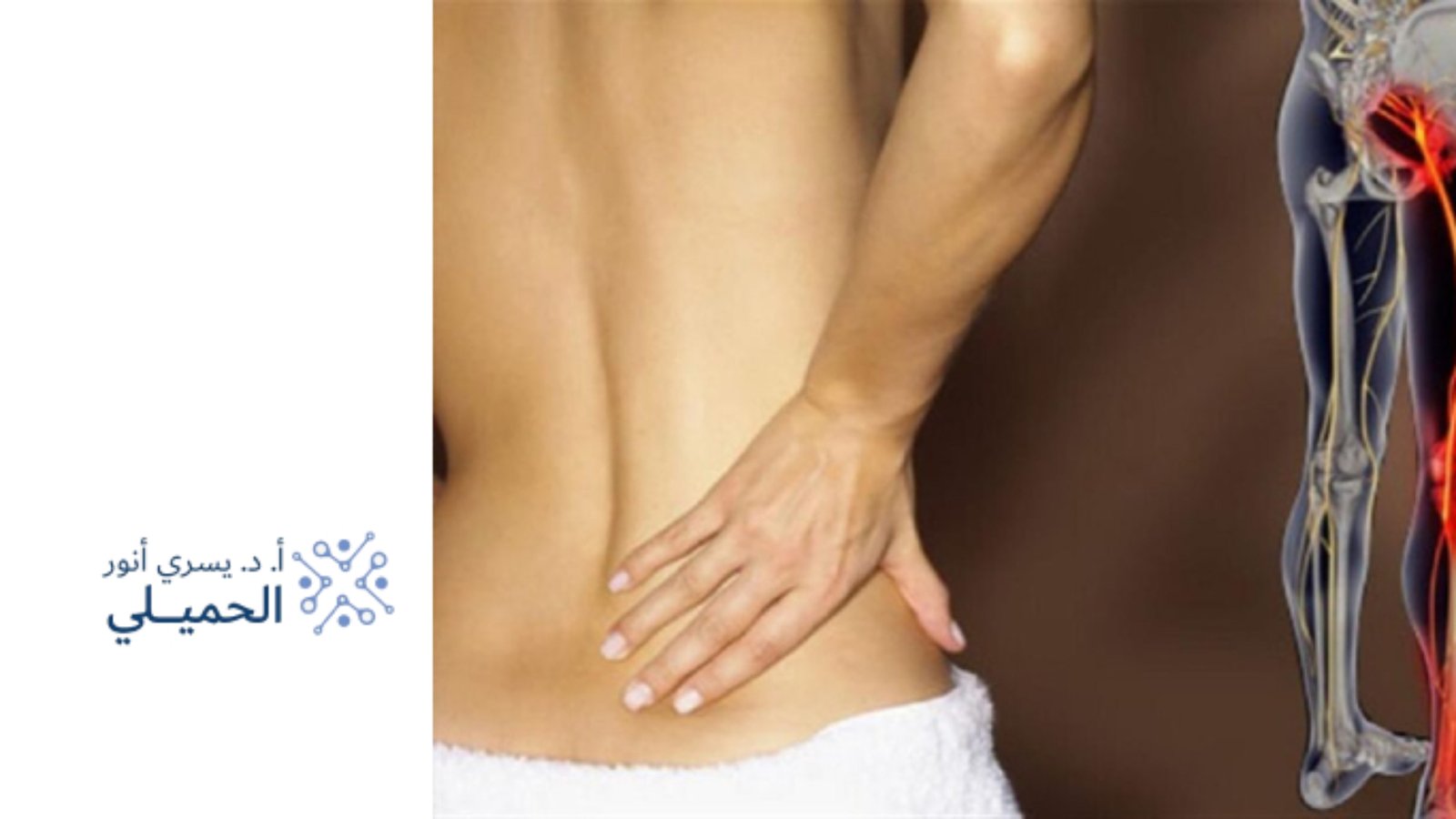 دكتور لعلاج عرق النسا في السعودية