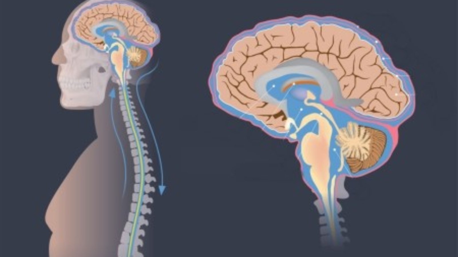 سعر صمام المخ في مصر
