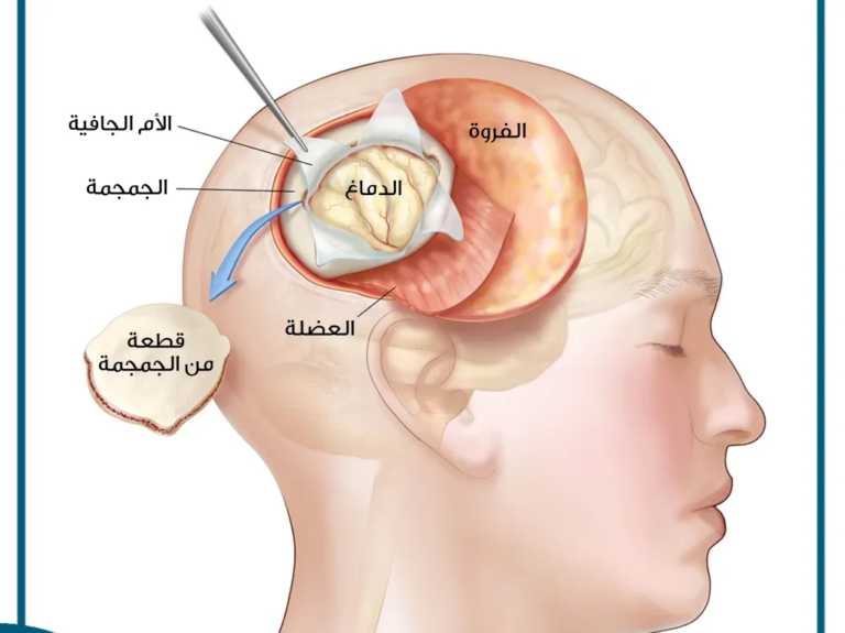 حالات شفيت من ورم الغدة النخامية