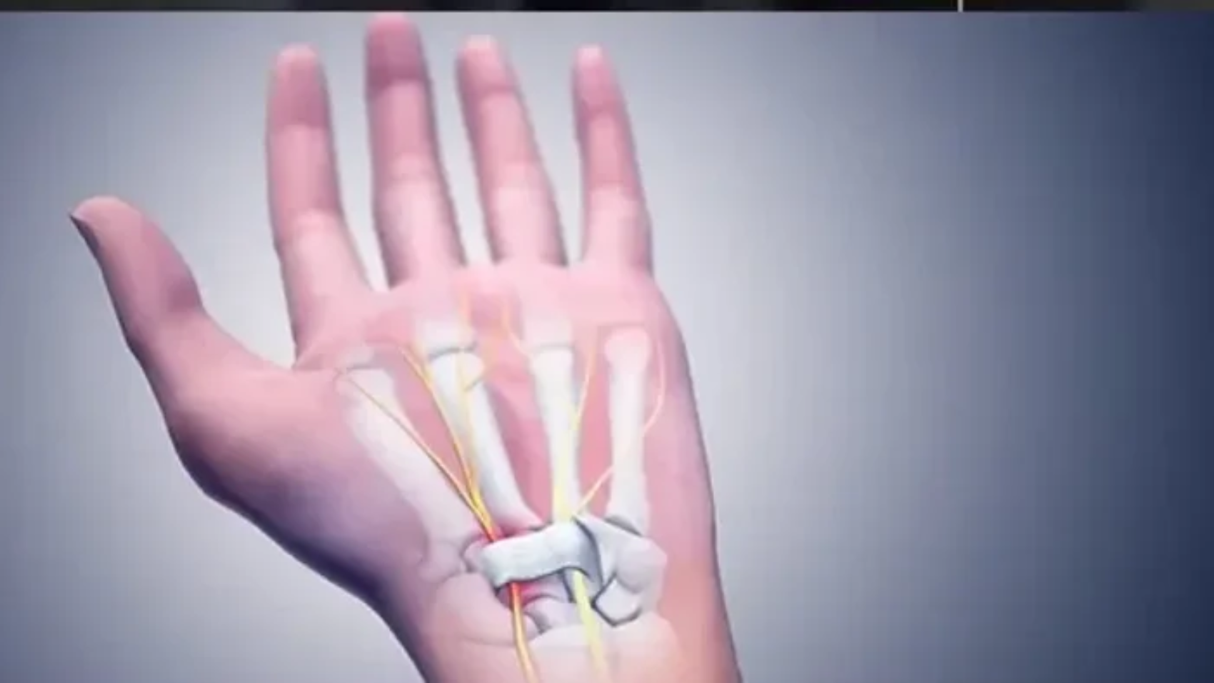 تسليك عصب اليد