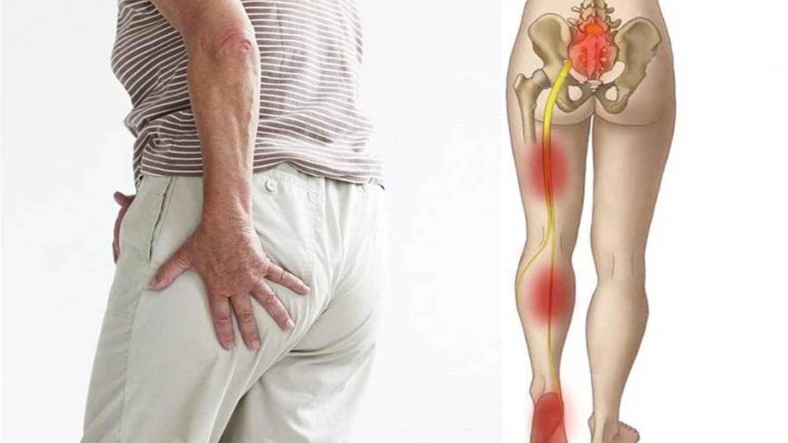 أفضل دكتور لعلاج عرق النسا