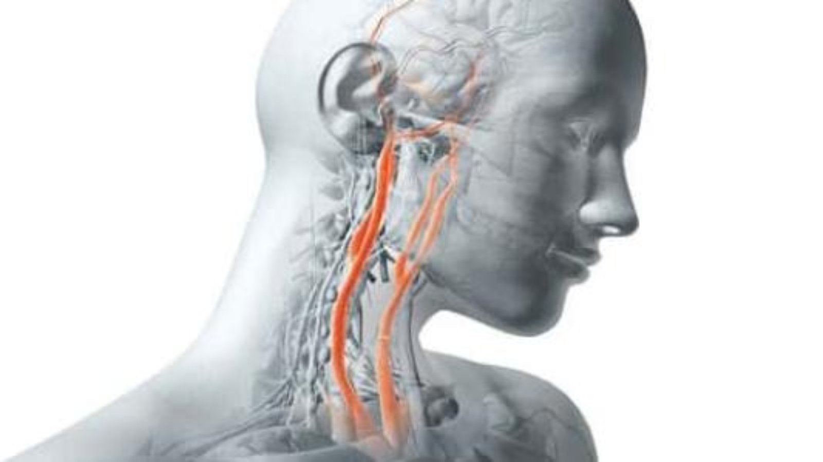 علاج ضيق الشريان السباتي