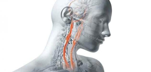 علاج ضيق الشريان السباتي