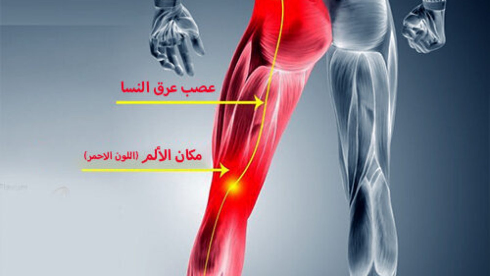 أعراض عرق النسا في الرجل اليسرى