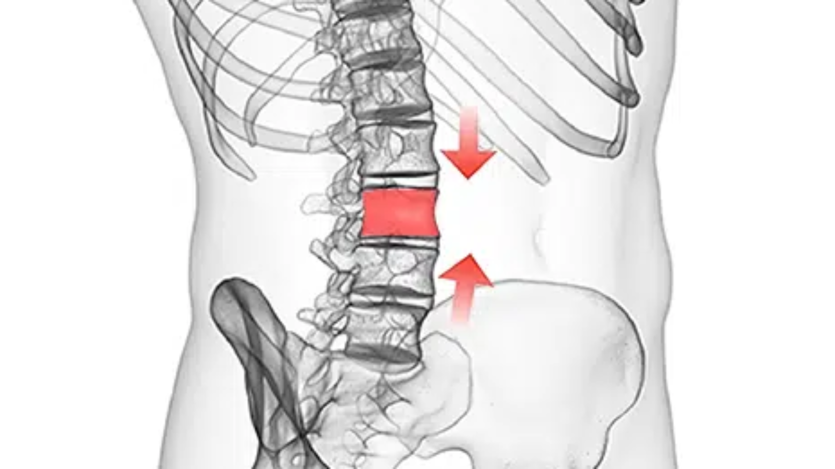 علاج كسر فقره الظهر في السعودية