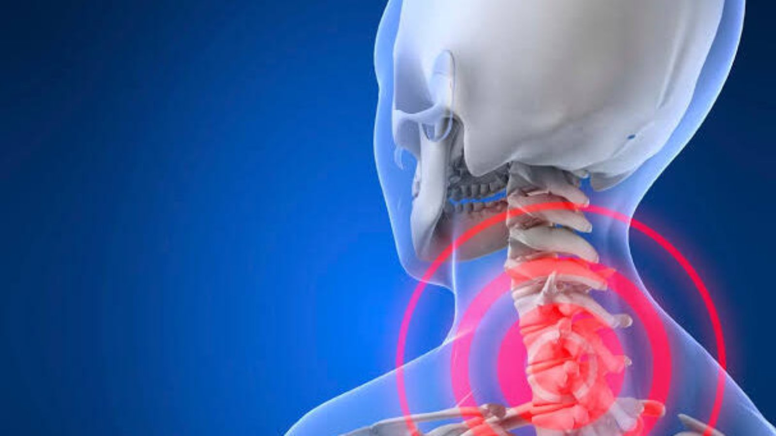 نسبة نجاح عملية غضروف الرقبة وأهم العوامل المؤثرة في نتائجها