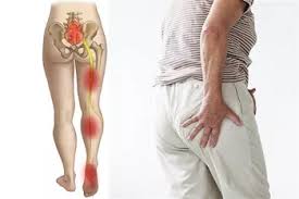 الأكل الممنوع لمرض عرق النسا | قائمة أطعمة تزيد الألم وكيف تتجنبها