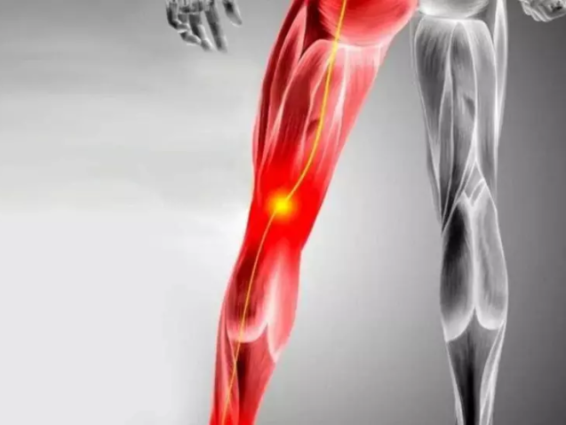 ما هي اعراض سرطان عرق النسا؟