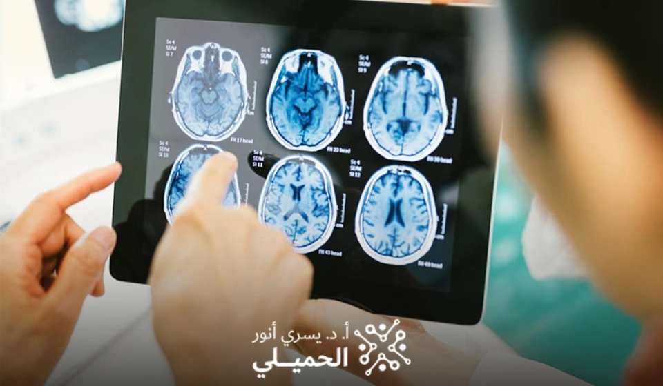 دكتور اعصاب واهم العمليات الجراحية التي يقوم بها في السعودية